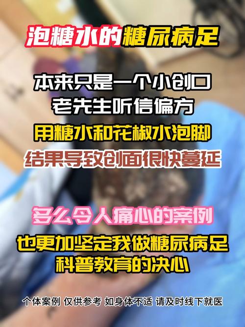 六台彩开奖特马和用花椒泡脚险晕厥与花椒水泡脚会头晕吗