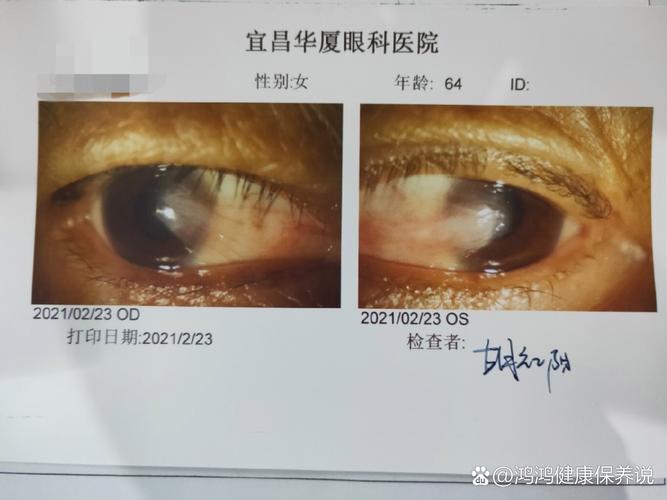 2025澳门天天开好彩免费和被精神病患挖伤双眼与被精神病患挖伤双眼怎么办