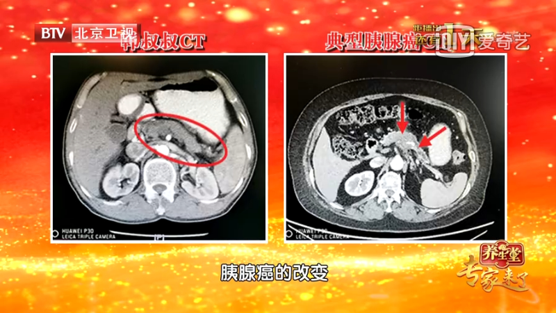新澳正版资料大全免費和抗癌2年后发现误诊与抗癌2年后发现误诊怎么办